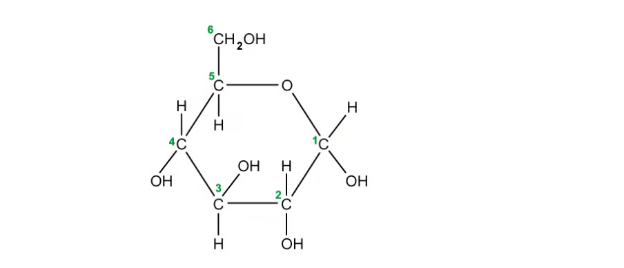 An artery with a fatty build up from cholesterol which leads to blockages in the coronary arteries and eventually heart attack